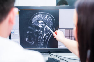 Experienced Lawyer for Brain Injury near Phoenix