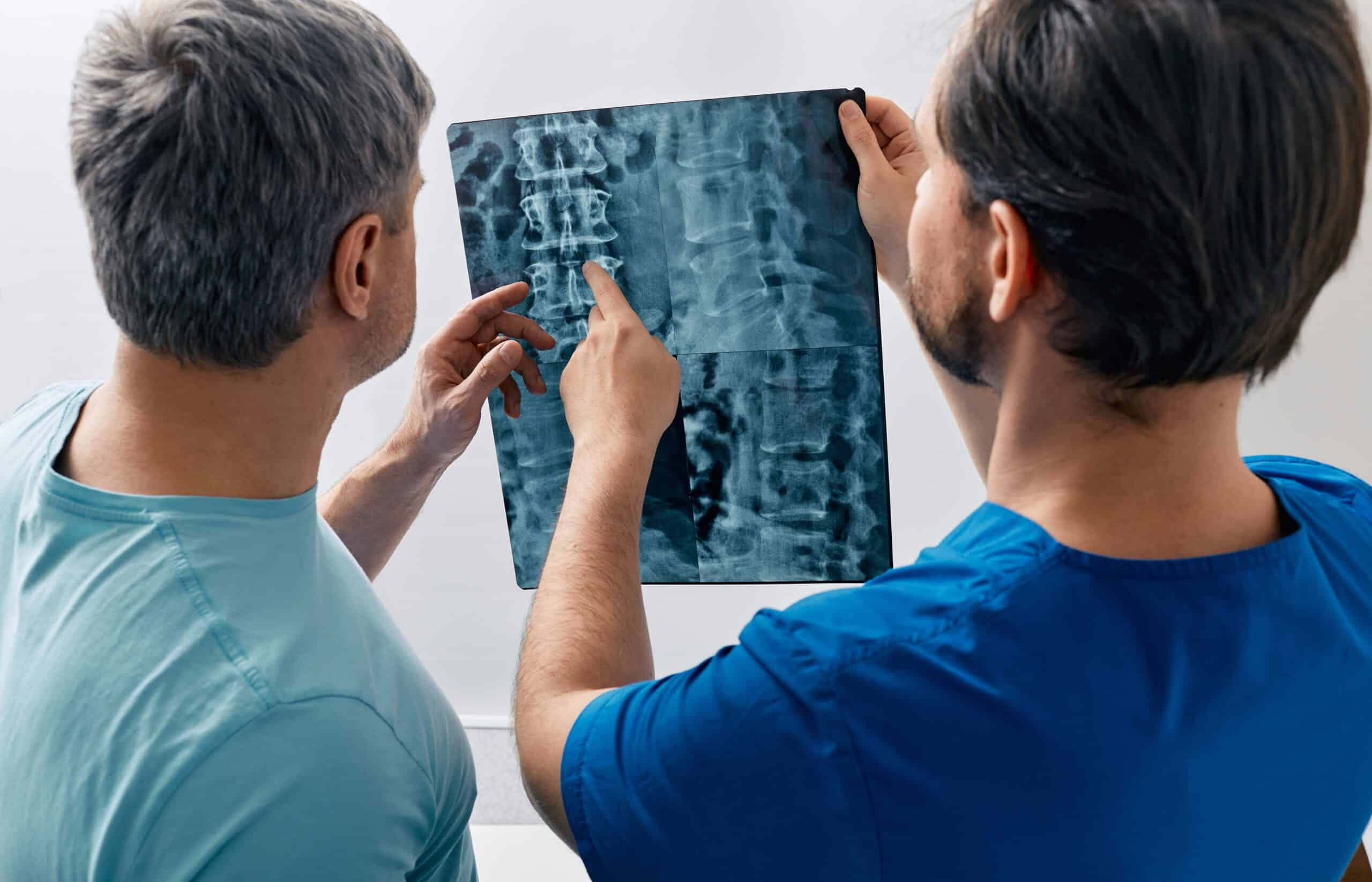 How Much Is My Spinal Cord Injury Worth in a Lawsuit