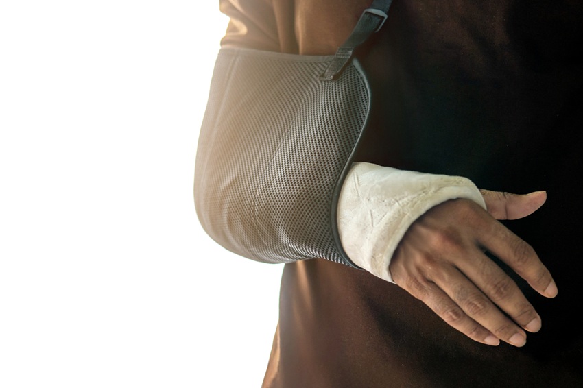 A close-up shot of a person wearing a black arm sling and a hand cast isolated on white background.